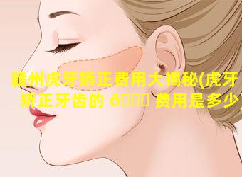 赣州虎牙矫正费用大揭秘(虎牙矫正牙齿的 🍁 费用是多少)